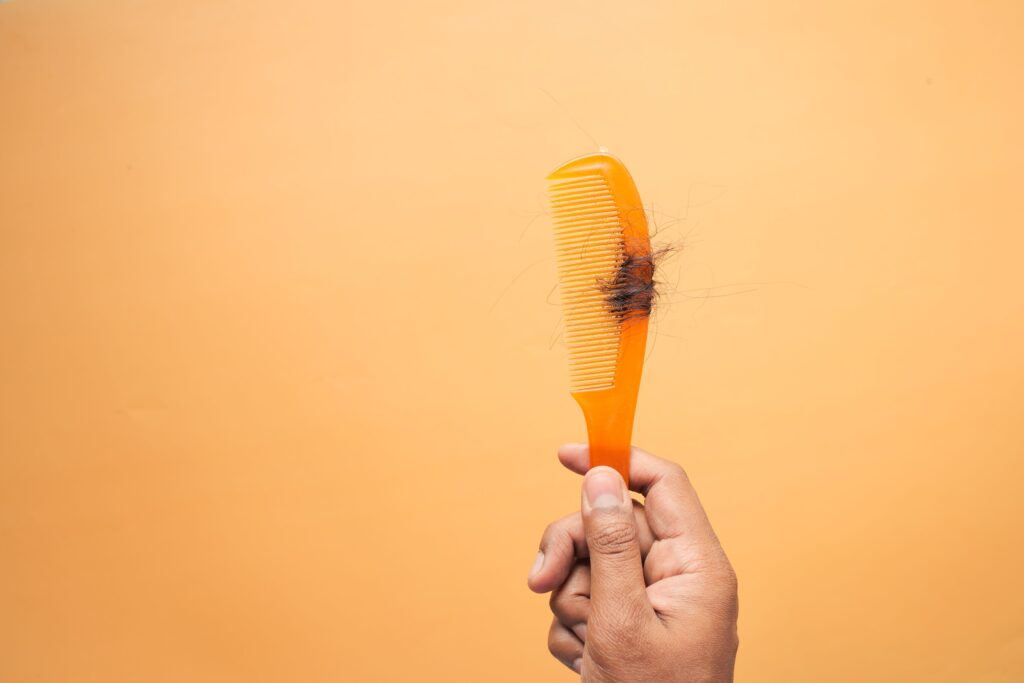 Hajhullás és vitaminhiány: mikor érdemes vizsgálni?